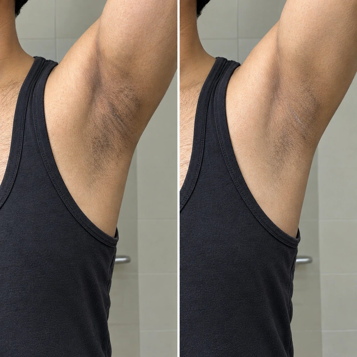 MORPHEUTIC Ice Roll-On underarm care — before and after comparison
