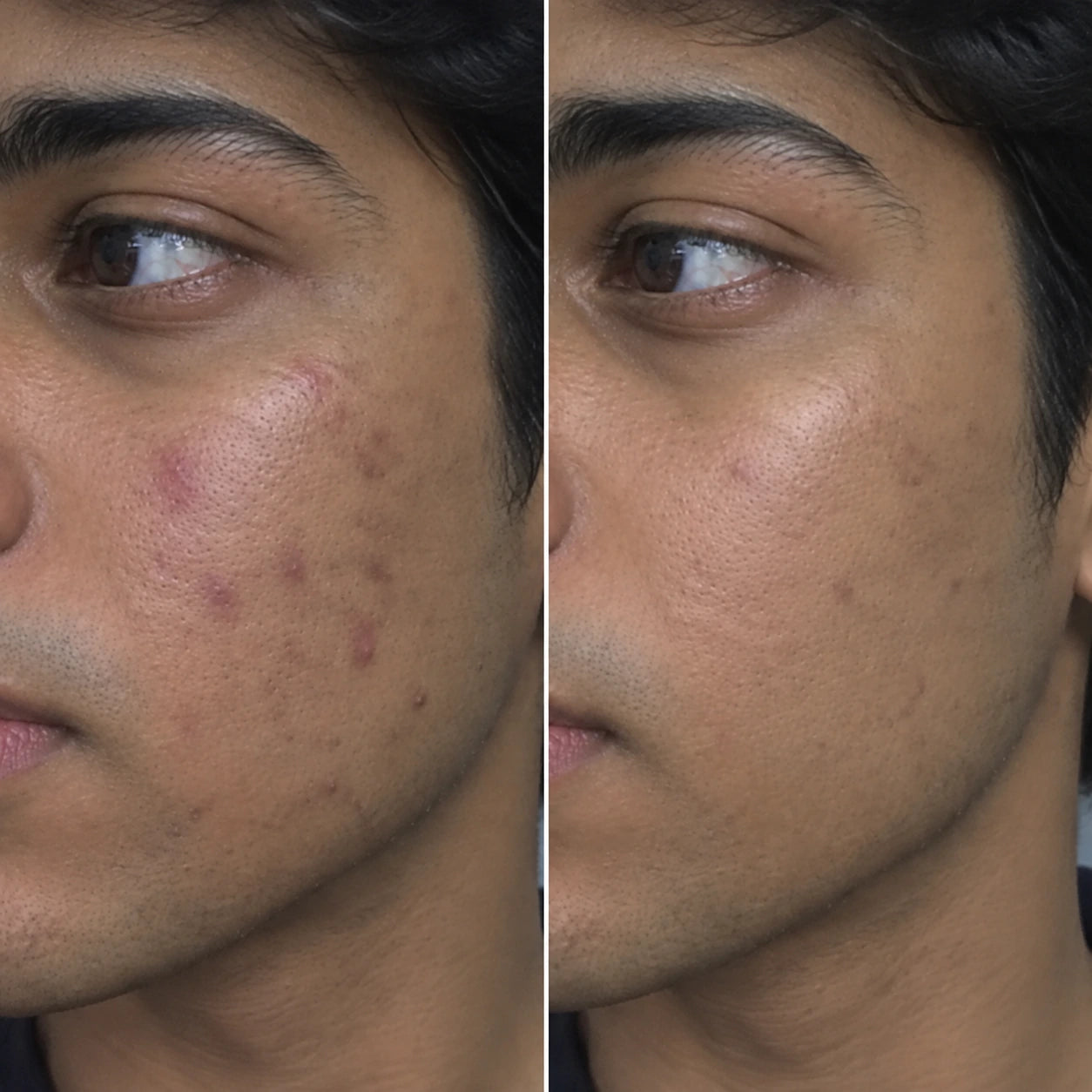 MORPHEUTIC PDRN Face Serum — before and after comparison