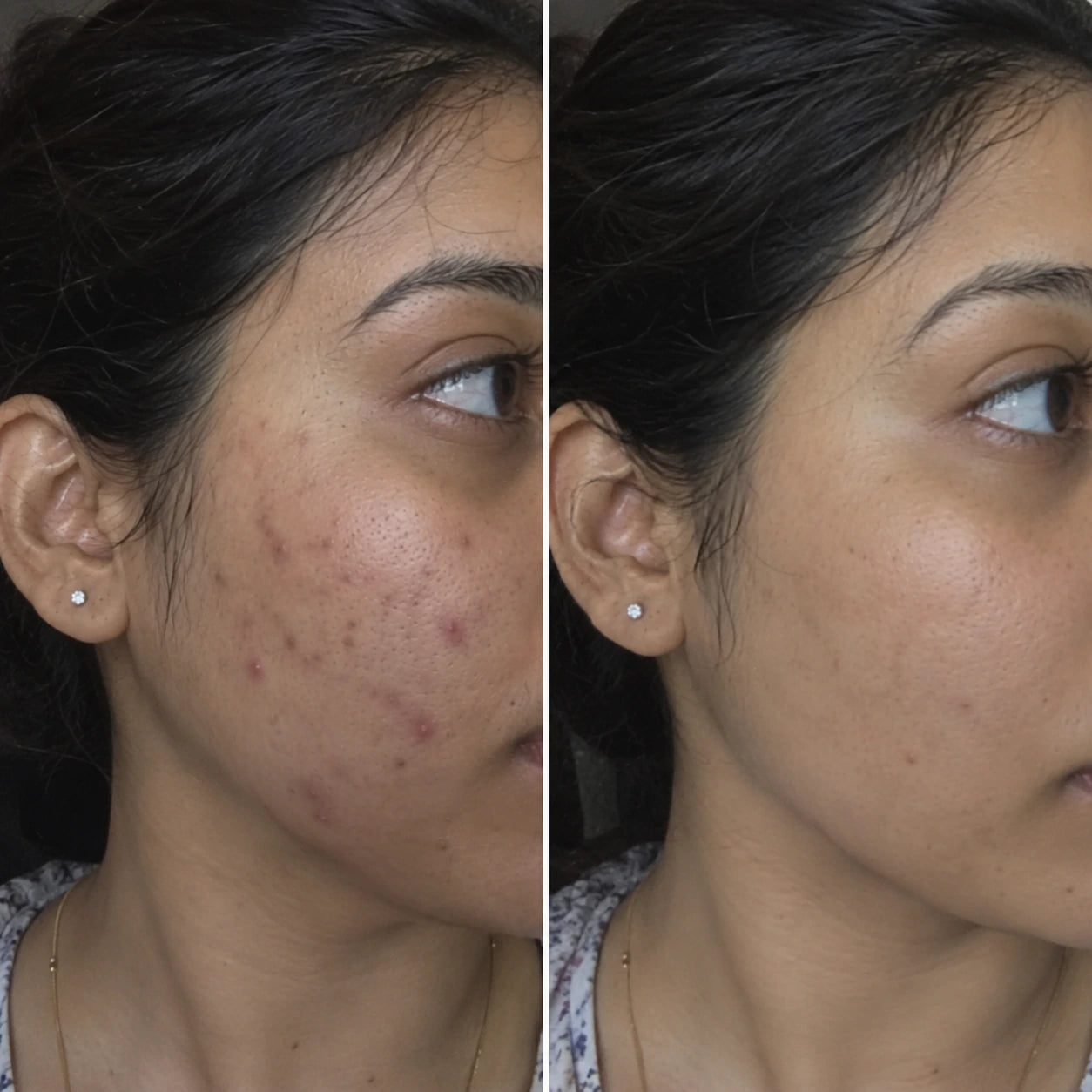 MORPHEUTIC PDRN Face Serum — before and after comparison
