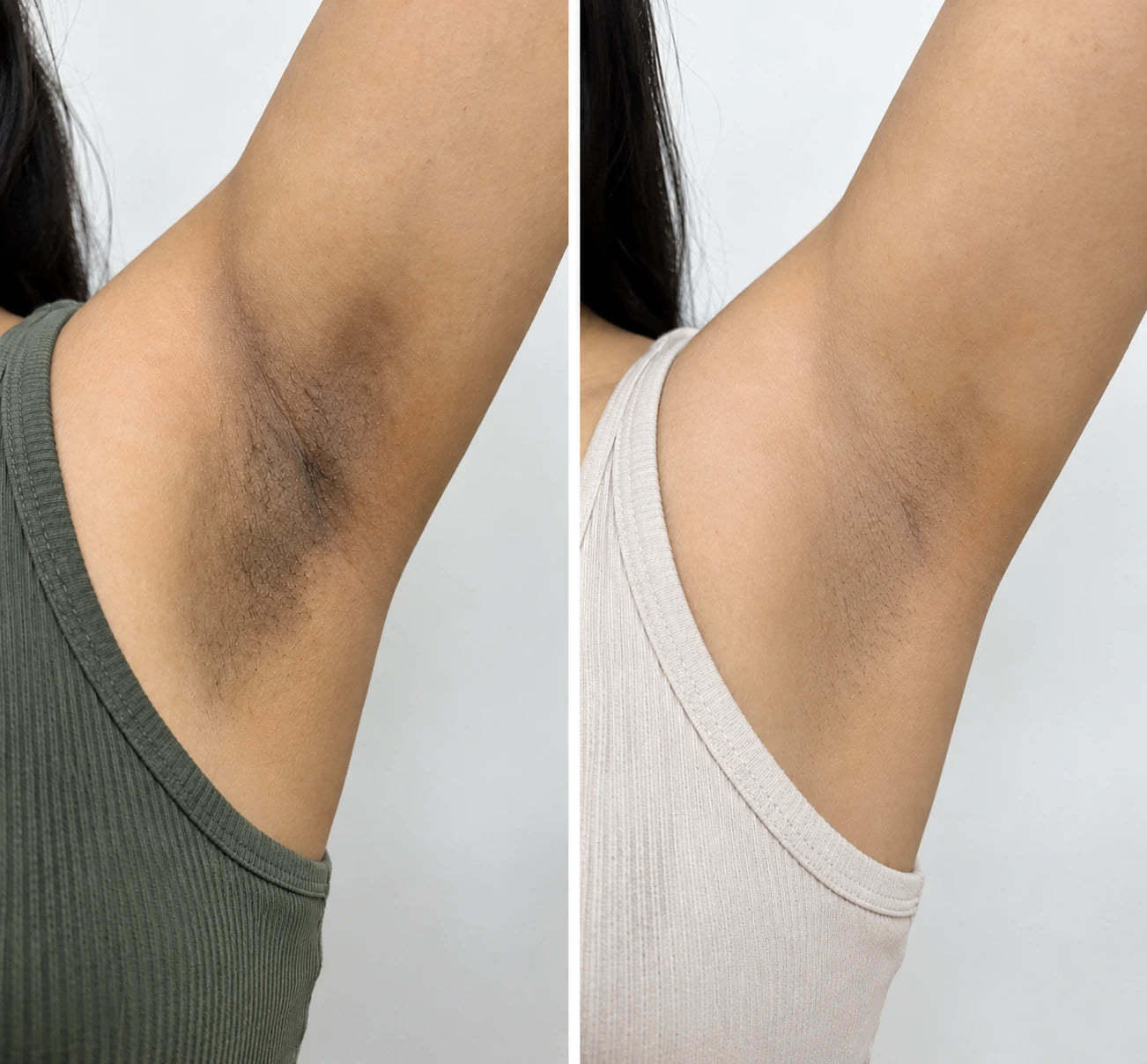 MORPHEUTIC Ice Roll-On underarm care — before and after comparison