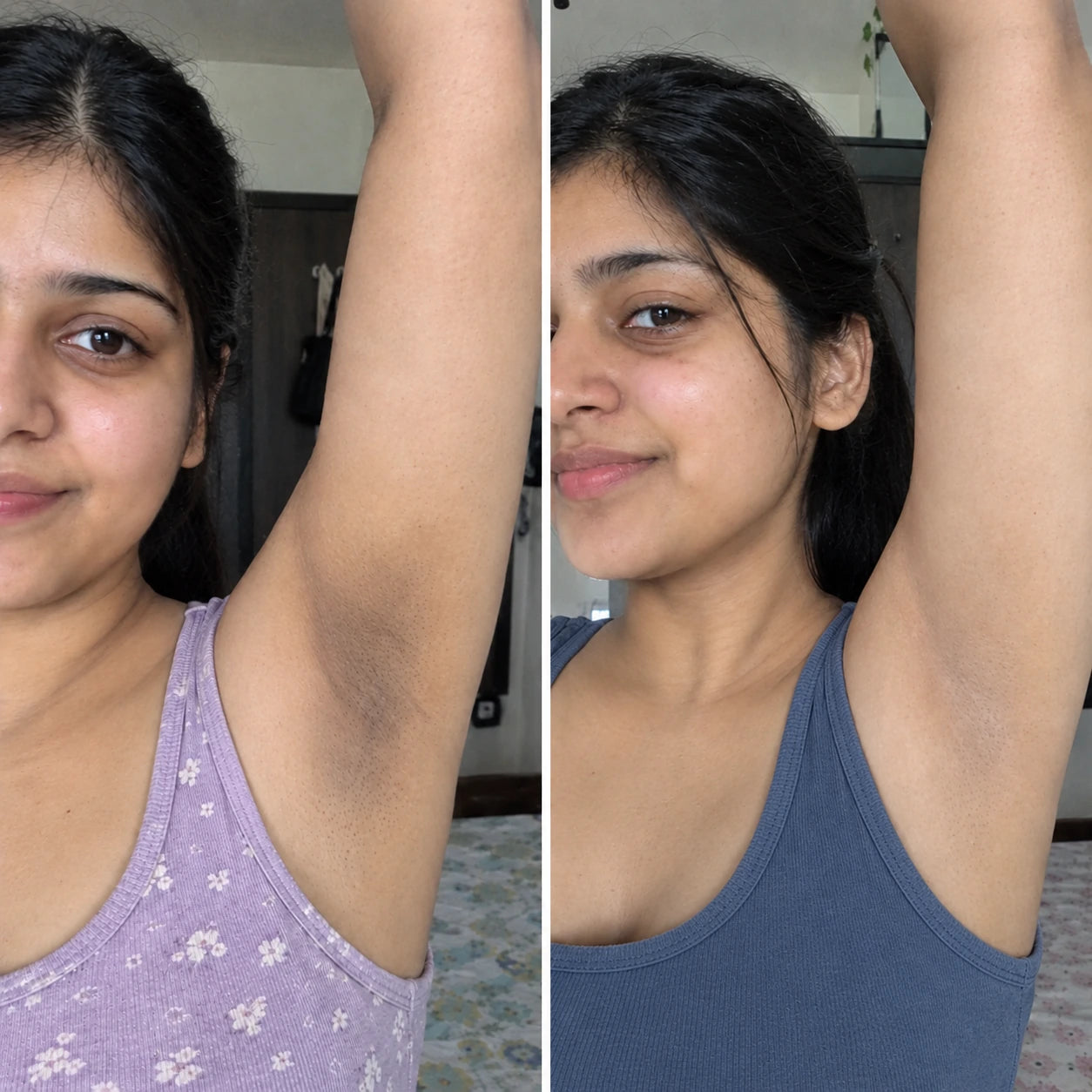 MORPHEUTIC Ice Roll-On underarm care — before and after comparison