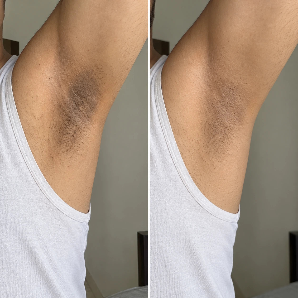 MORPHEUTIC Ice Roll-On underarm care — before and after comparison
