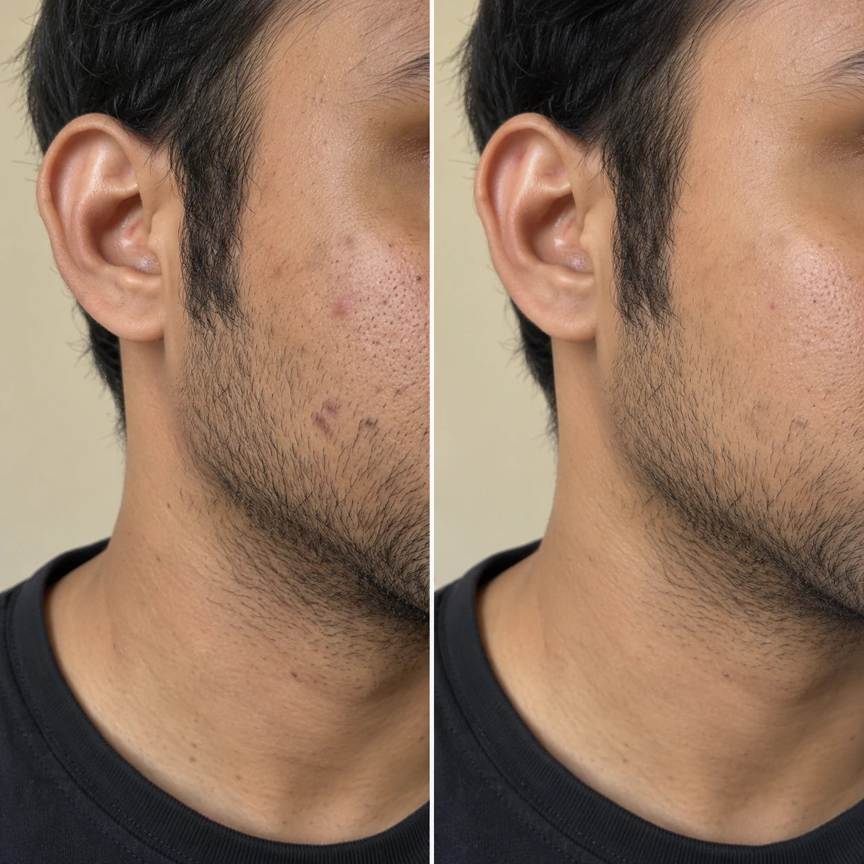 MORPHEUTIC PDRN Face Serum — before and after comparison